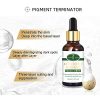 Aichun Beauty Facial Serum Anti-freckle Essence Nicotinamide Green Tea Extract Moisturizing Smooth Delicate 30ml | 1 Fl.oz