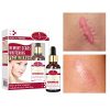 Aichun Beauty Scar Removal Facial Serum Pimples Stretch Marks Face Moisturizing Body Remove Scars Kojic Acid Vitamin E 30ml