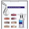 Bioaqua Anti-acne Serum Removal Of Acne Essence Liquid 30ml