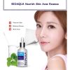 Bioaqua Anti-acne Serum Removal Of Acne Essence Liquid 30ml