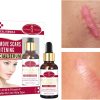 Aichun Beauty Scar Removal Facial Serum Pimples Stretch Marks Face Moisturizing Body Remove Scars Kojic Acid | Vitamin – E | 30ml
