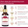Aichun Beauty Scar Removal Facial Serum Pimples Stretch Marks Face Moisturizing Body Remove Scars Kojic Acid | Vitamin – E | 30ml