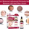 Aichun Beauty Scar Removal Facial Serum Pimples Stretch Marks Face Moisturizing Body Remove Scars Kojic Acid | Vitamin – E | 30ml