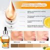 Aichun Beauty Scar Removal Facial Serum Pimples Stretch Marks Face Moisturizing Body Remove Scars Kojic Acid | Vitamin – E | 30ml